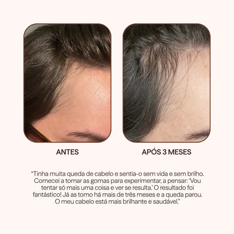 Gomas Para o Cabelo Brownie