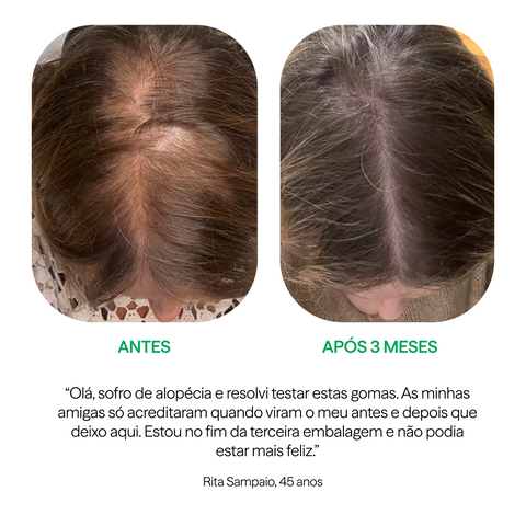 Gomas Para o Cabelo